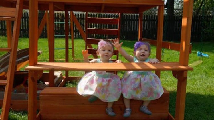 Estas gemelas se agarraron de la mano al nacer... ¡Y ahora son inseparables!