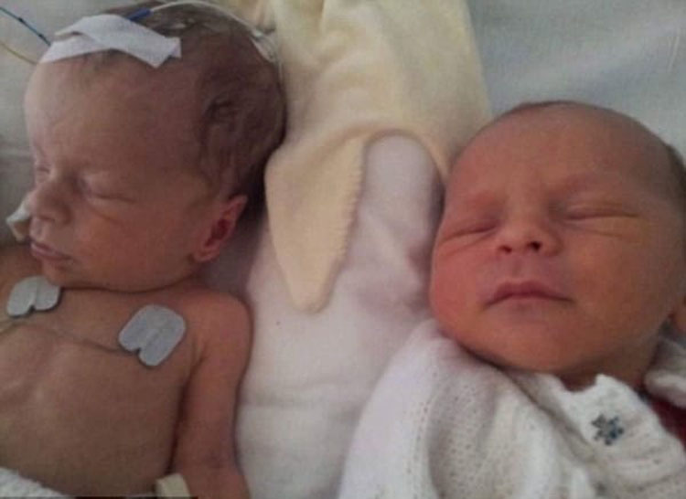 Este recién nacido sufre convulsiones y hemorragias cerebrales, hasta que ponen a su hermano gemelo en su incubadora